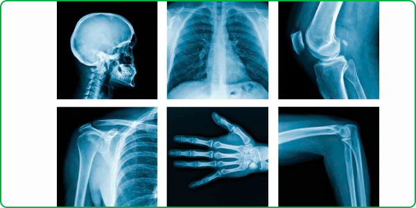 Все виды рентгена в «LS Clinic» Алматы